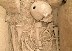 Uno de los esqueletos con el cráneo trepanado. 